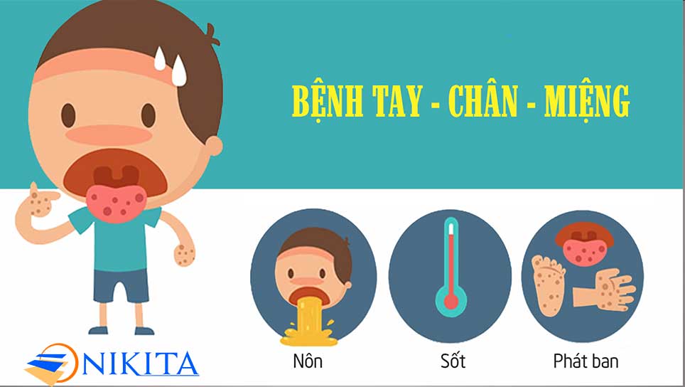 Bệnh tay chân miệng ở trẻ nhỏ